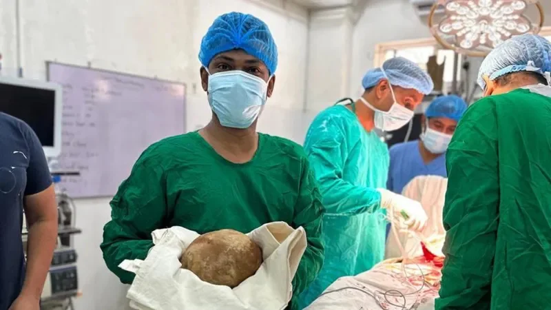 অস্ত্রোপচার করে মূত্রথলি থেকে বের করা হল ৩.১ কেজি ওজনের পাথর